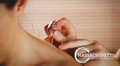 The Benefits of Acupuncture for Addiction Recovery